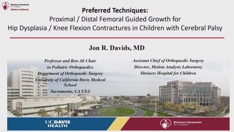 Thumbnail for IPOS® 2022: Guided Growth: Neuromuscular Hip and Knee