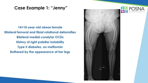 Thumbnail for Role of Pyschology in Presurgical Assessment