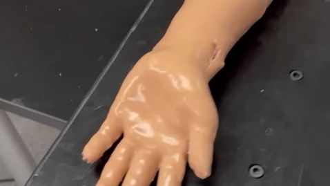 Thumbnail for Advanced Pediatric Supracondylar Humeral Fracture Simulation Model with Reduction and Fixation