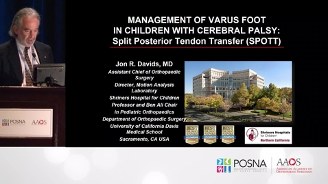 Thumbnail for entry Split Posterior Tendon Transfer in Cerebral Palsy