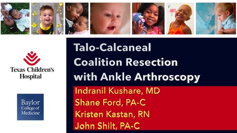 Thumbnail for Video Abstract 1: Talo-Calcaneal Coalition Resection with Ankle Arthroscopy