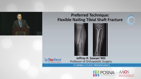 Thumbnail for Flexible IM Rods for Tibial Shaft Fracture