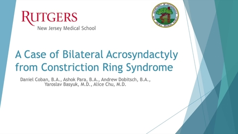 Thumbnail for Video Abstract 12: A Case of Bilateral Acrosyndactyly from Constriction Ring Syndrome