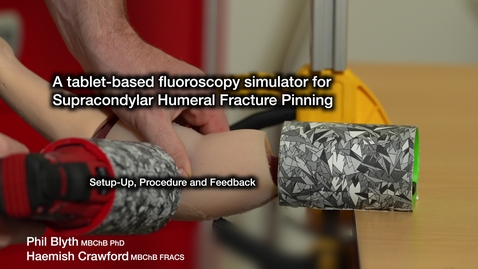 Thumbnail for A Tablet-based Fluoroscopy Simulator for Supracondylar Humeral Fracture Pinning