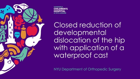 Thumbnail for entry Closed Reduction of Developmental Dislocation of the Hip with Application of a Waterproof Cast 