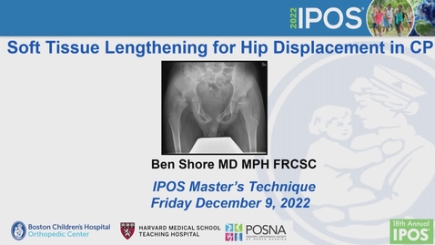 Thumbnail for entry IPOS® 2022: Soft Tissue Release for Spastic Hip Subluxation