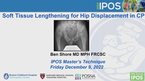 Thumbnail for IPOS® 2022: Soft Tissue Release for Spastic Hip Subluxation