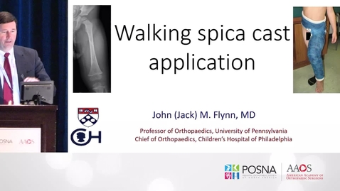 Thumbnail for entry Walking Spica Cast Application