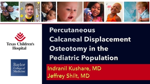 Thumbnail for entry Percutaneous Calcaneal Displacement Osteotomy in the Pediatric Population
