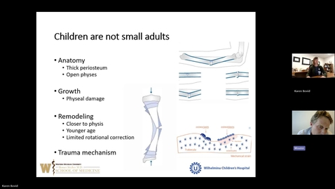 Thumbnail for 5. Tibia Shaft Fractures: When Is It Appropriate to Rigid Nail?