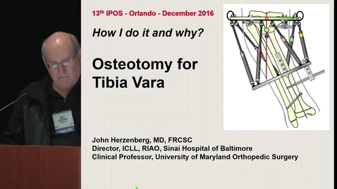 Thumbnail for Osteotomy for Tibia Vara