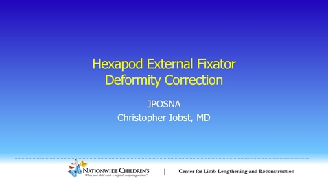 Thumbnail for entry Hexapod External Fixator Deformity Correction