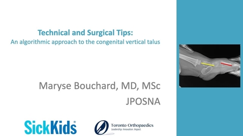 Thumbnail for entry Technical and Surgical Tips:  An algorithmic approach to the congenital vertical talus