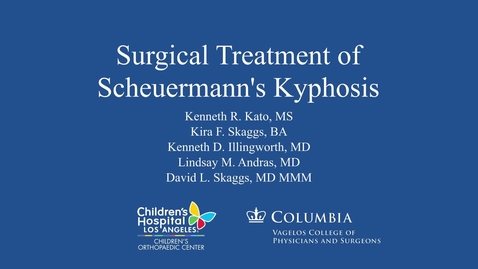 Thumbnail for entry Surgical Treatment of Scheuermann's Kyphosis