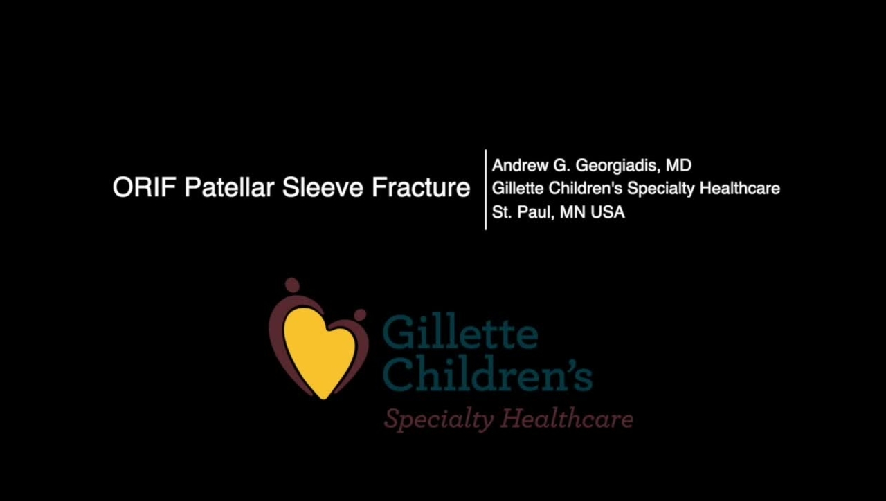 ORIF Patellar Sleeve Fracture