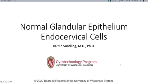 Thumbnail for Genetics 570 - Normal Endocervical_final