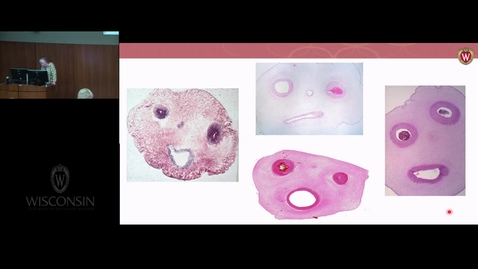 Thumbnail for Development of the Nervous System and Structures of the Head and Neck Part 2