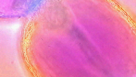 Thumbnail for through-focused cell