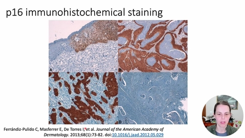 Thumbnail for Genetics 573 Male Genital tract IHC and molecular biomarkers