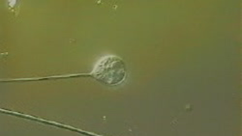 Thumbnail for detail