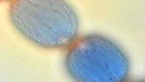 Thumbnail for 2cellsmov