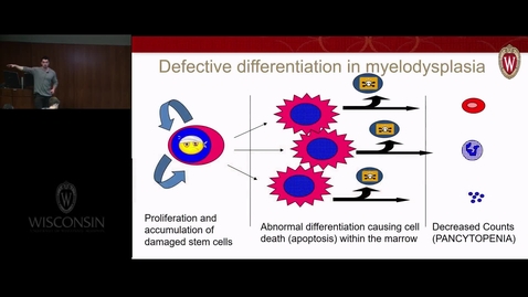 Thumbnail for Myeloid Malignancies and Acute Leukemia 2