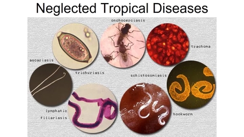 Thumbnail for Intro to NTDs PART 1