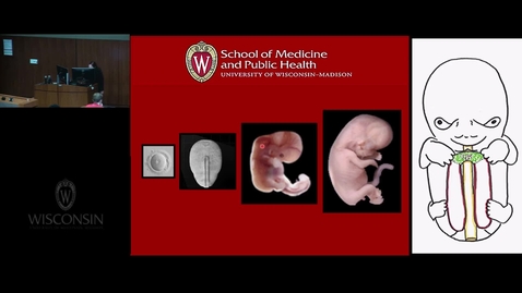 Thumbnail for HFT - REC Early Embryology