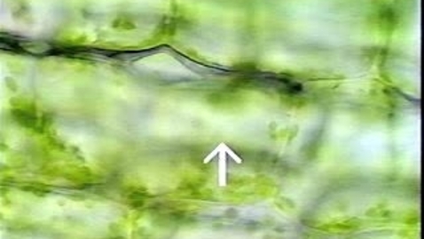 Thumbnail for Through-focus Elodea