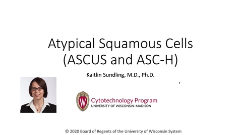 Thumbnail for 3 FA20_570_AtypicalSquamous.mov
