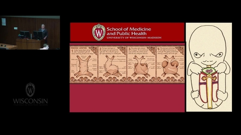 Thumbnail for HFT - RECNormal Development of the Heart
