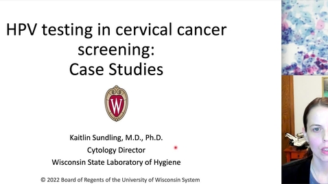 Thumbnail for 2022-06 WSC Sundling HPV Part 2_smaller.mov