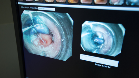 Thumbnail for entry Gastroenterology Scope – Internal view