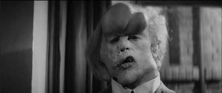 You're Romeo — the final close-up in the Shakespearean scene of The Elephant Man