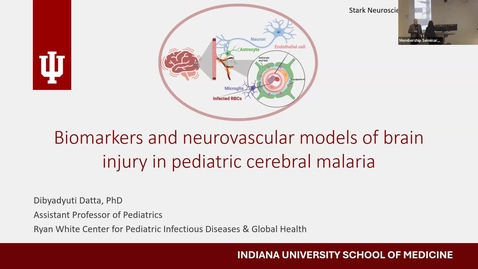 Thumbnail for SNRI Membership Seminar: Dibyadyuti Datta, MS, PhD &amp; Yehui Zhu, PhD, MSN | April 7, 2026