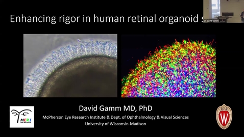 Thumbnail for SNRI Seminar Series: David Gamm, MD, PhD | March 12, 2026
