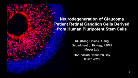 Thumbnail for Neurodegeneration of glaucoma patient retinal ganglion cells derived from human pluripotent stem cells