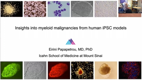 Thumbnail for entry IUSCCC Seminar 3/9/2023: “Insights into myeloid malignancies from human iPSC models” Eirini Papapetrou, M.D., Ph.D.
Associate Professor Icahn School of Medicine at Mount Sinai
