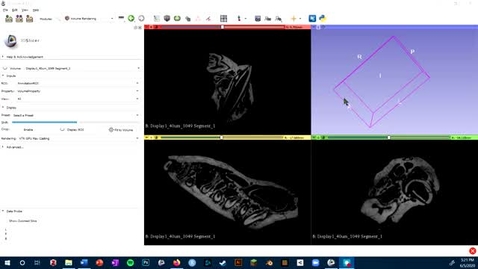 Thumbnail for entry Video 7 - 3D Slicer: Volume Rendering Module