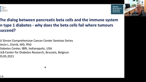 Thumbnail for entry IUSCCC Virtual Seminar Series 5/20/2021: “The dialog between pancreatic beta cells and the immune system in type 1 diabetes - why does the beta cells fail where tumours succeed?” Decio L. Eizirik, M.D., Ph.D. Professor, 
ULB Center for Diabetes Researc