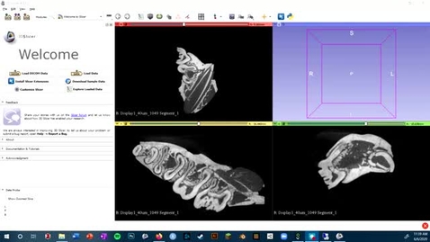 Thumbnail for Video 5.2 - 3D Slicer: Resampling Volumes