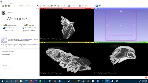 Thumbnail for entry Video 5.2 - 3D Slicer: Resampling Volumes