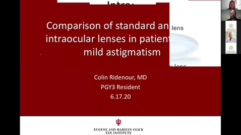 Thumbnail for Comparison of standard and toric intraocular lenses in patients with mild astigmatism