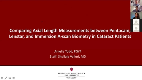 Thumbnail for entry Comparing axial length measurements between Pentacam, Lenstar, and immersion A-scan biometry in cataract patients