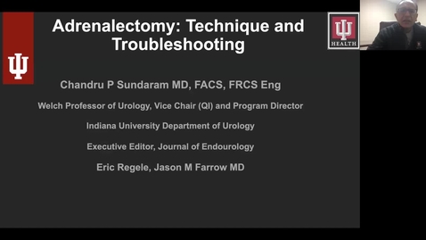 Thumbnail for entry 4.15.21 Adrenalectomy with Dr. Sundaram