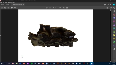 Thumbnail for entry Video 9 - 3D Slicer: Segmenting in the Segment Editor