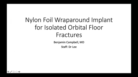 Thumbnail for entry Nylon foil wraparound implant for isolated orbital floor fractures