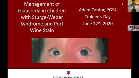 Thumbnail for entry Management of glaucoma in children with Sturge-Weber Syndrome and Port Wine Stain