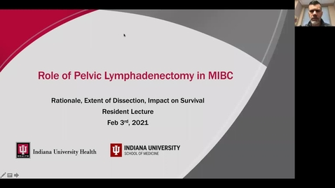 Thumbnail for entry 2.3.21 Extended Pelvic Node Dissection with Dr. Masterson