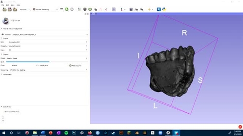 Thumbnail for Video 8 - 3D Slicer: Cropping Volumes
